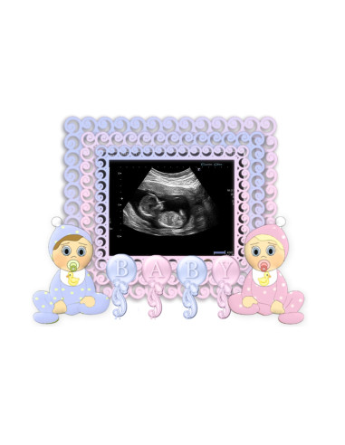 Fotokruus sinu kõhubeebist teatamiseks