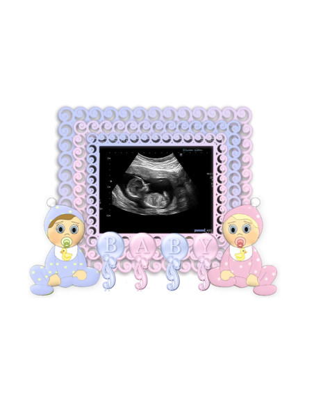 Fotokruus sinu kõhubeebist teatamiseks