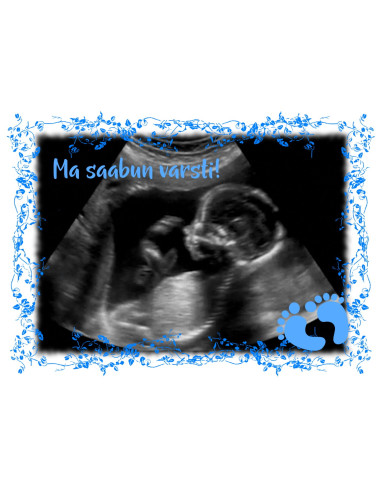 Must värvimuutev fototass BEEBIPOISS ON SAABUMAS Must värvimuutev fototass BEEBIPOISS ON SAABUMAS