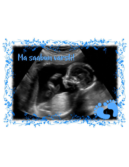 Must värvimuutev fototass BEEBIPOISS ON SAABUMAS Must värvimuutev fototass BEEBIPOISS ON SAABUMAS