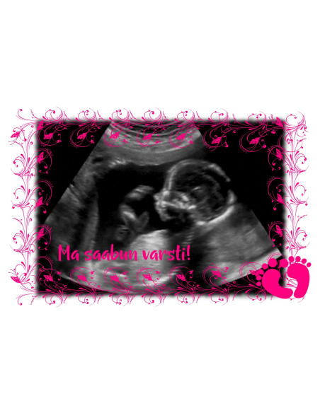 Must värvimuutev fototass BEEBITÜDRUK ON SAABUMAS